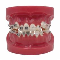 Modelo To-Bracket Metal y Zafiro