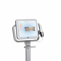 Itero Escaner Intraoral
