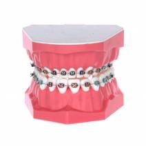 Tipodonto Adulto con Brackets Metálicos 32 dientes