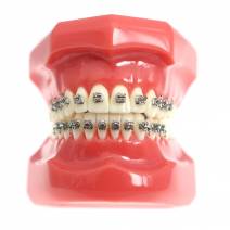 Tipondonto Modelo con Brackets Interactivos Metálicos de Estudio SlimDent