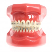 Tipondonto Modelo con Brackets Interactivos Cerámicos de Estudio SlimDent