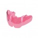 MyoBrace for Kids K1 Accesorio Intraoral Preventivo Ortodoncia, Rosa 1 unidad Myofunctional