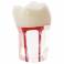 Molar Conductos Radiculares Modelo Prácticas Endodoncia Bader