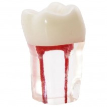 Molar Conductos Radiculares Modelo Prácticas Endodoncia Bader