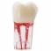 Molar Conductos Radiculares Modelo Prácticas Endodoncia Bader