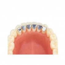 Kit Retenedores Canino Canino Inferior Cementado Directo 10 uds Leone