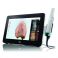 iTero Lumina Version Mobile Escáner Intraoral con Tecnología MDC
